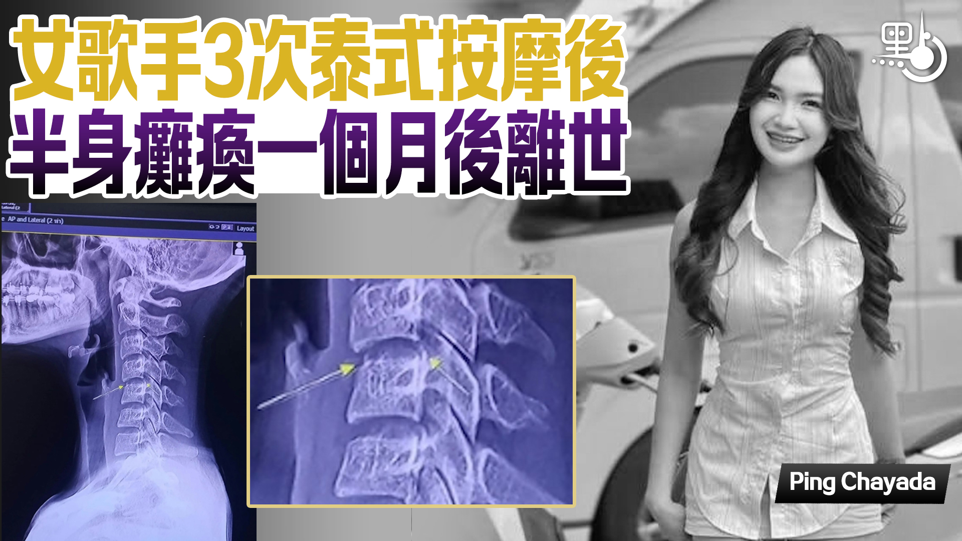 女歌手3次泰式按摩後半身癱瘓一個月後離世- 生活- 點新聞