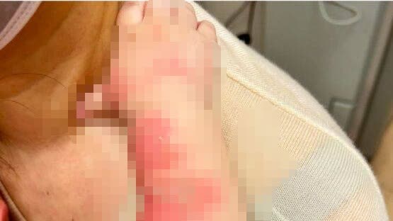 Sha Tin domestic helper holds 1-year-old baby in kitchen, causing second-degree burns