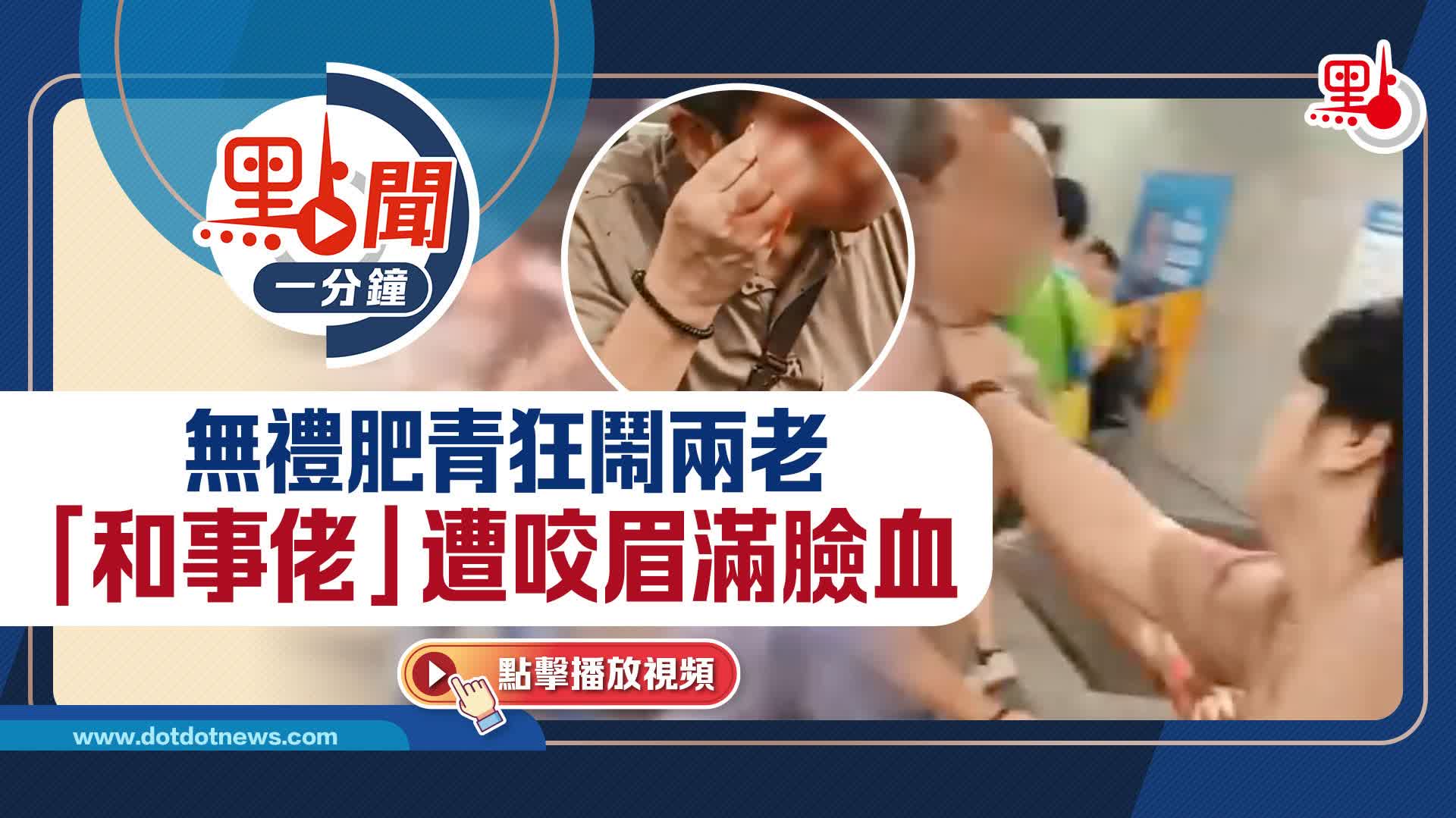 點聞1分鐘｜無禮肥青狂鬧兩老　「和事佬」遭咬眉滿臉血