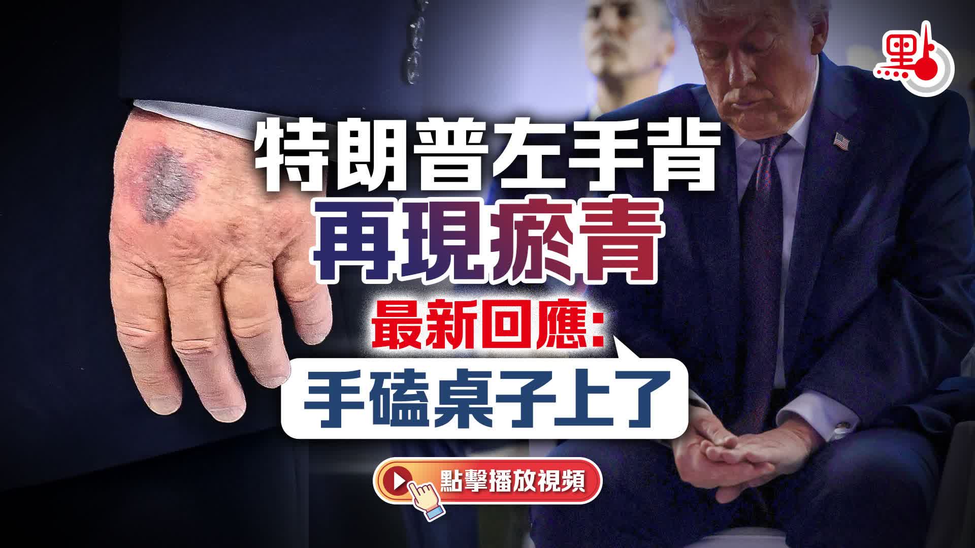 （有片）特朗普左手背再現瘀青　最新回應：手磕桌子上了