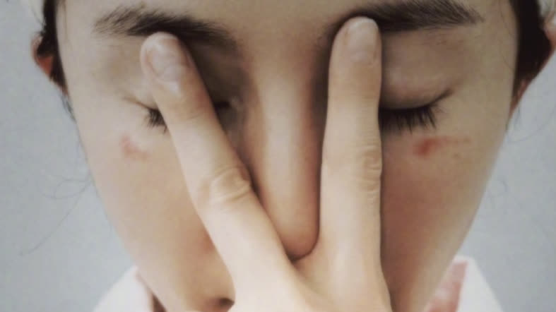 Actress Yang Mi suffers facial burns from steam eye mask: Doctors warn of hidden risks