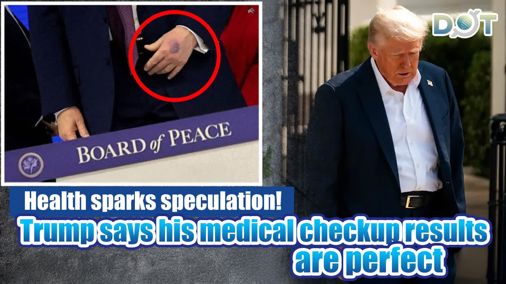 Health sparks speculation! Trump says his medical checkup results are perfect