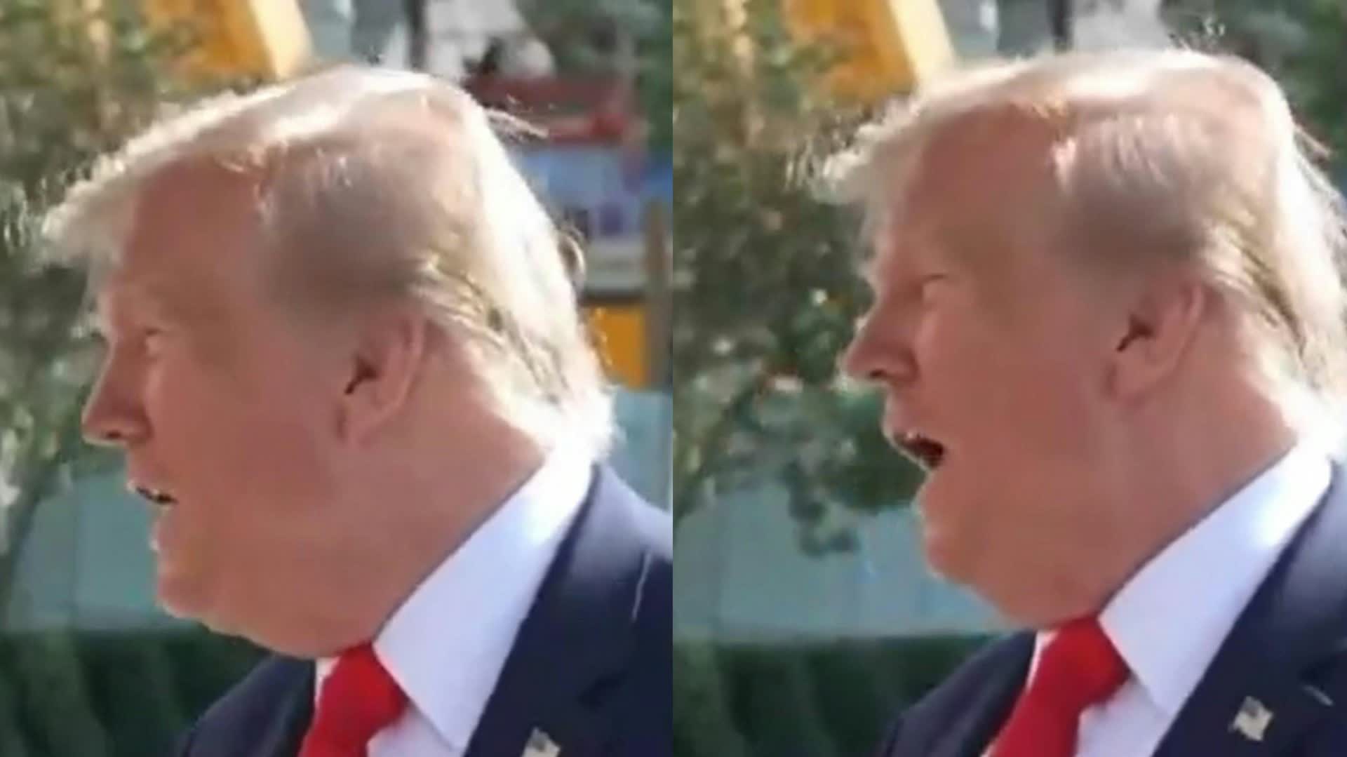Trump seen with noticeable bruise on left side of face, fueling fresh health speculation