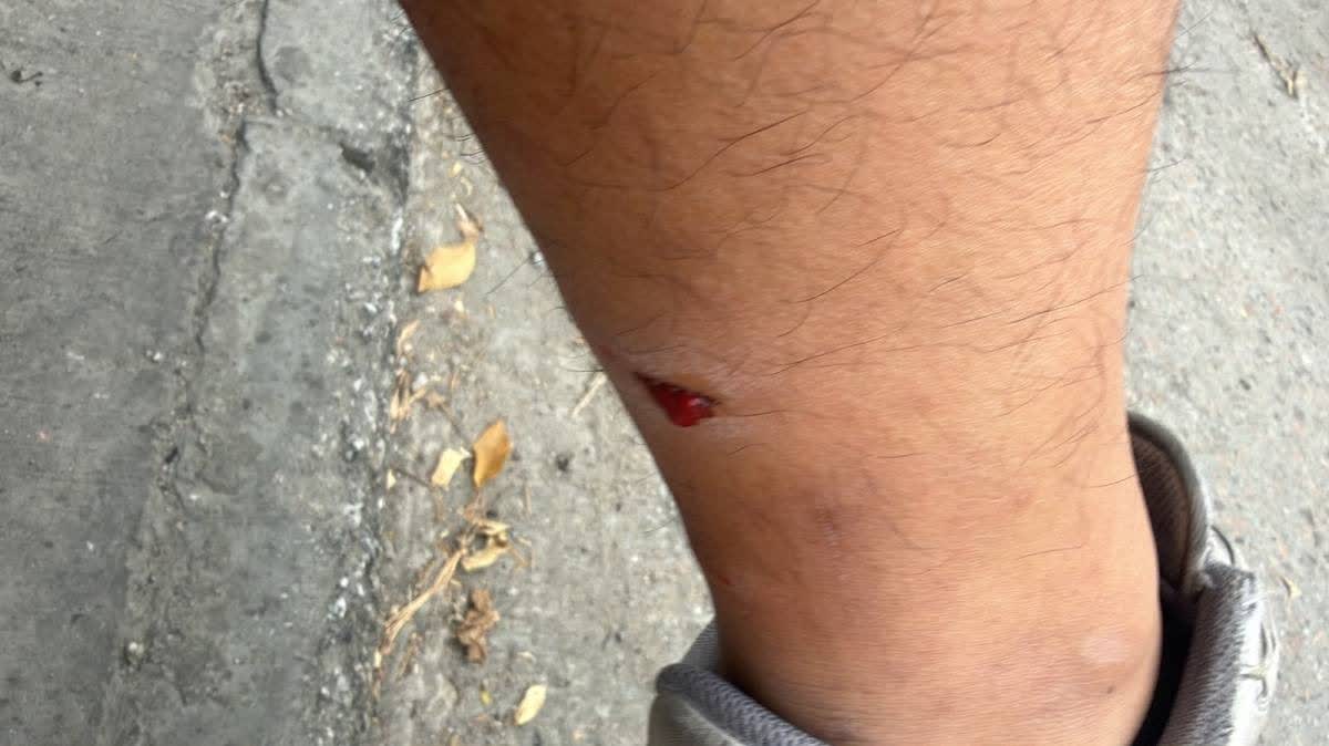 Yuen Long dog attack again! Man chased by 3 dogs on Pok Wai Road, bitten on calf by one dog and hospitalised